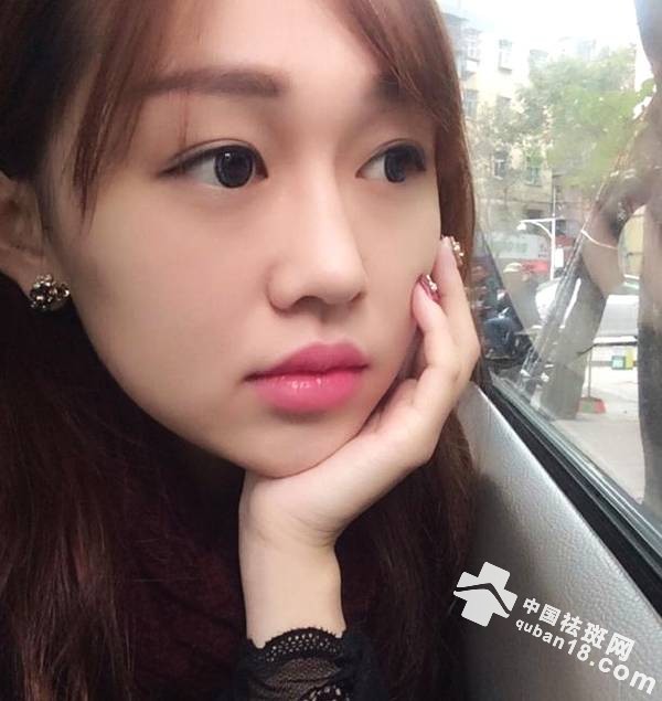 <a href=http://www.quban18.com/tag/ban/>祛<a href=http://www.quban18.com/tag/ban_4098/>斑</a></a>不花一分钱,只要一块“它”洗<a href=http://www.quban18.com/qubanbuwei/lian/><a href=http://www.quban18.com/tag/lian/>脸</a></a>,三天<a href=http://www.quban18.com/tag/ban/>祛<a href=http://www.quban18.com/tag/ban_4098/>斑</a></a><a href=http://www.quban18.com/tag/chuzhou/>除皱</a>,<a href=http://www.quban18.com/tag/anquan/>安全</a>不<a href=http://www.quban18.com/tag/fandan/>反弹</a>